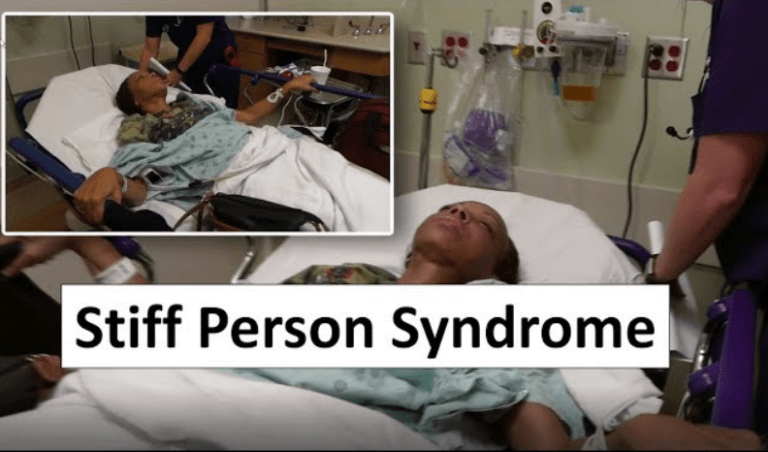 Stiff Person Syndrom: Ein Überblick über eine seltene neurologische Erkrankung
